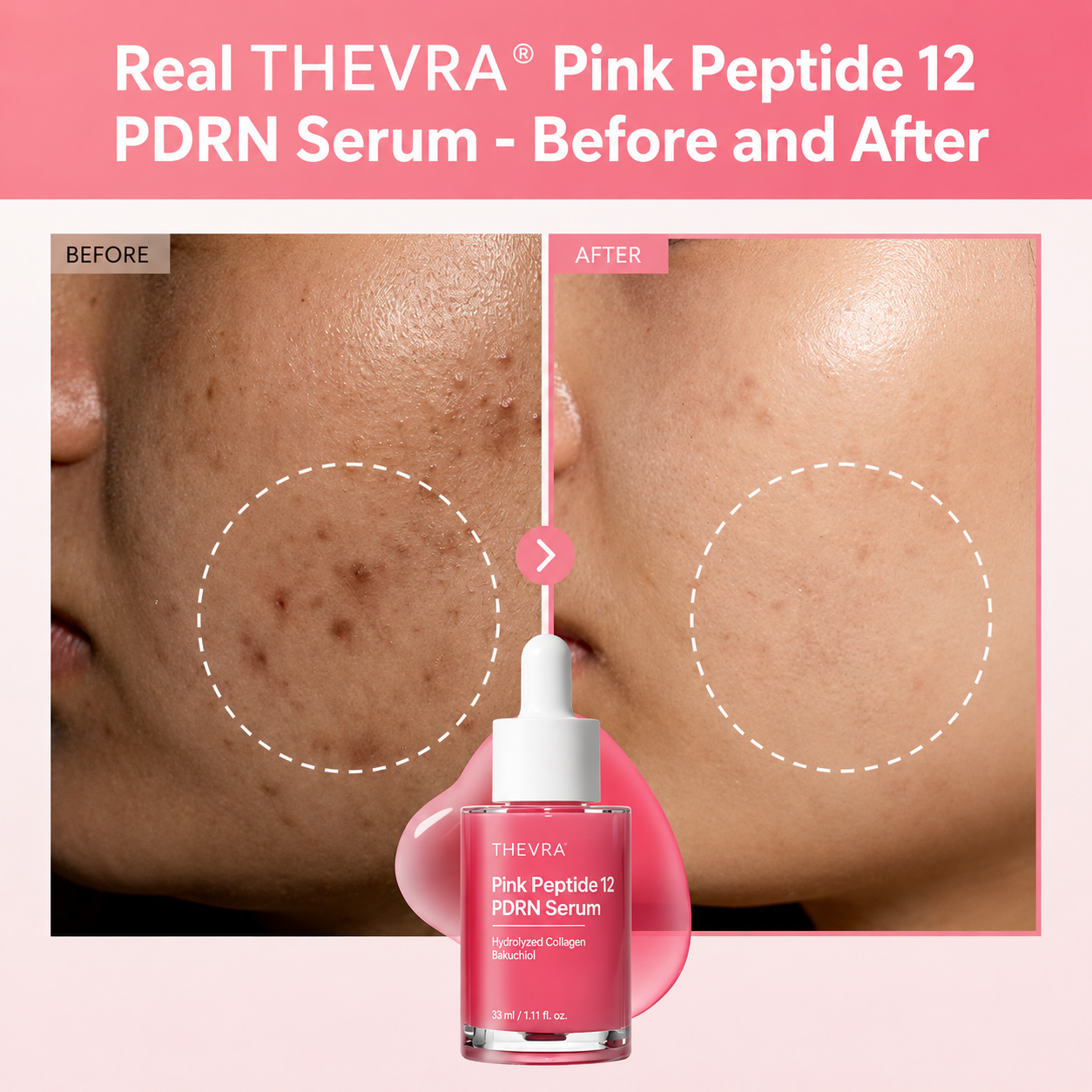 Pink Peptide PDRN Renewal Serum